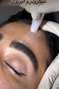 نمونه درمان مشکلات پوستی دکتر سید محمدرضا قریشی