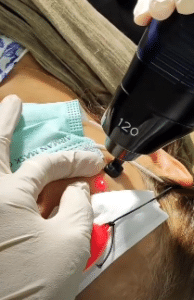 نمونه درمان بیماری های پوستی دکتر آسیه صابری