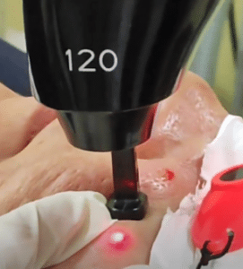 نمونه درمان بیماری های پوستی دکتر آسیه صابری