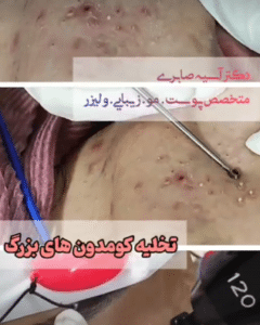 نمونه درمان بیماری های پوستی دکتر آسیه صابری