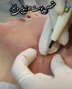 نمونه درمان بیماری های پوستی دکتر آسیه صابری