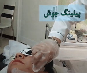 نمونه درمان بیماری های پوستی دکتر آسیه صابری