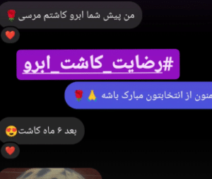 نظر کاربر اینستاگرام (کلینیک کاشت مو و ابرو پدیده)