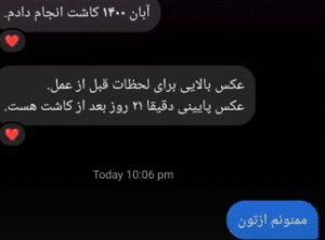 نظر کاربر اینستاگرام (کلینیک کاشت مو و ابرو پدیده)