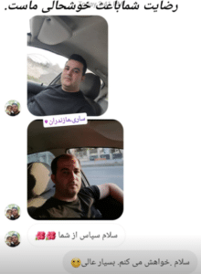 نمونه کاشت مو (کلینیک کاشت موی آرا)