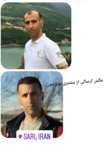 نمونه کاشت مو (کلینیک کاشت موی آرا)