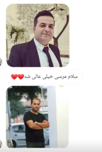 نمونه کاشت مو (کلینیک کاشت موی آرا)