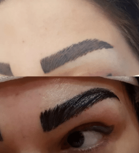نمونه کاشت ابرو (کلینیک کاشت موی آرا)