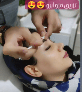 نمونه کاشت ابرو (کلینیک کاشت موی آرا)