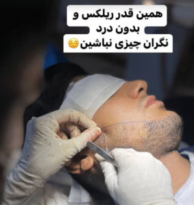 نمونه کاشت مو دکتر محمود جعفری (کلینیک رز سفید)