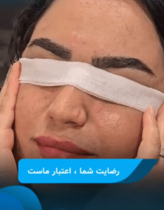 نمونه کاشت ابرو دکتر محمود جعفری (کلینیک رز سفید)