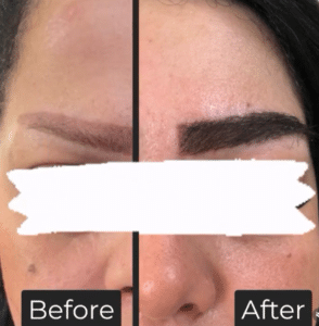 نمونه کاشت ابرو دکتر قاسم رحمت پور رکنی