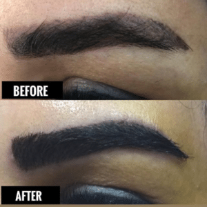 نمونه کاشت ابرو دکتر قاسم رحمت پور رکنی