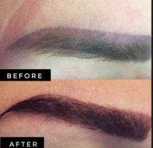 نمونه کاشت ابرو دکتر قاسم رحمت پور رکنی