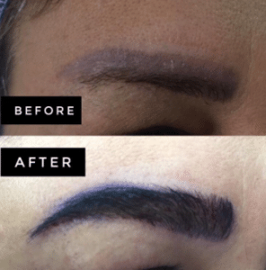 نمونه کاشت ابرو دکتر قاسم رحمت پور رکنی