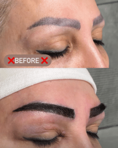 نمونه کاشت ابرو دکتر قاسم رحمت پور رکنی