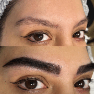 نمونه کاشت ابرو کلینیک زیبایی ژینو
