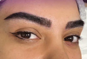 نمونه کاشت ابرو کلینیک زیبایی ژینو