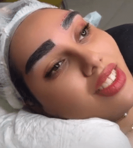 نمونه کاشت ابرو کلینیک زیبایی دانژه