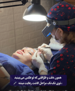 نمونه کاشت ابرو کلینیک زیبایی دانژه