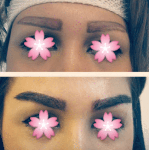 نمونه کاشت ابرو کلینیک طبیب