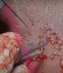 نمونه کاشت مو کلینیک زیبایی و لاغری آسا