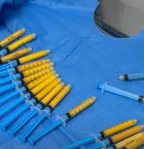 نمونه تزریق چربی دکتر مینا ملا احمدی