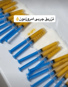 نمونه تزریق چربی دکتر مینا ملا احمدی