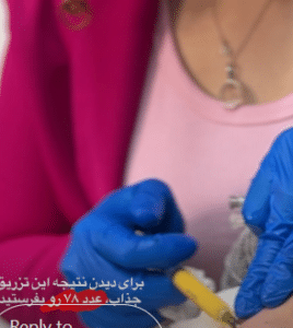 نمونه تزریق چربی دکتر مینا ملا احمدی