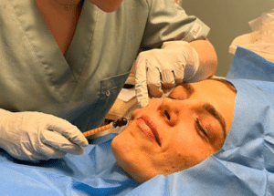 نمونه تزریق چربی دکتر زهره حاج حیدری