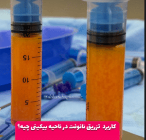 نمونه تزریق چربی دکتر هدی حق نظر