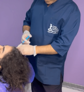 نمونه مزوتراپی برای درمان ریزش مو دکتر قاسم رحمت پور رکنی