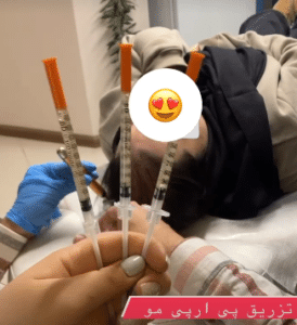 نمونه درمان ریزش مو با prp دکتر محمود جعفری