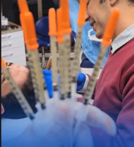 نمونه درمان ریزش مو با prp دکتر محمود جعفری