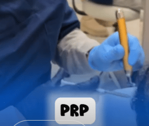 نمونه درمان ریزش مو با prp دکتر محمود جعفری