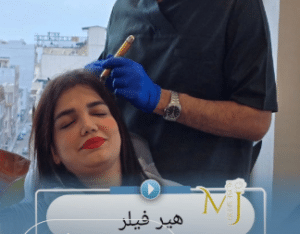 نمونه درمان ریزش مو با هیرفیلر دکتر محمود جعفری