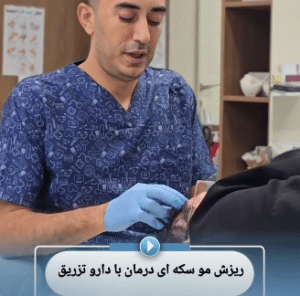 نمونه درمان ریزش مو با درمان های ترکیبی دکتر محمود جعفری