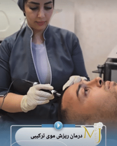 نمونه درمان ریزش مو با درمان های ترکیبی دکتر محمود جعفری