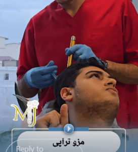 نمونه درمان ریزش مو با مزوتراپی دکتر محمود جعفری