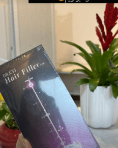 نمونه درمان ریزش مو به روش هیرفیلر دکتر زهره حاج حیدری