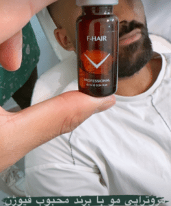 نمونه درمان ریزش مو به روش مزوتراپی دکتر محمدامین صنعتی