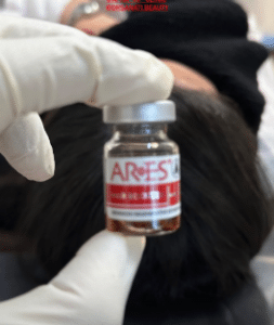 نمونه درمان ریزش مو به روش مزوتراپی دکتر محمدامین صنعتی