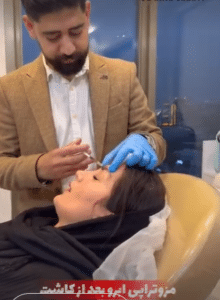 نمونه درمان ریزش مو به روش مزوتراپی دکتر محمدامین صنعتی