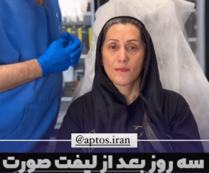 نمونه لیفت با نخ دکتر حسین خسروی