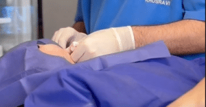 نمونه لیفت با نخ دکتر حسین خسروی