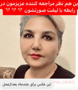 نمونه جراحی لیفت صورت دکتر امید اعتماد
