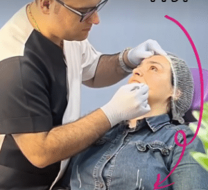 نمونه لیفت صورت دکتر محسن پور آریا