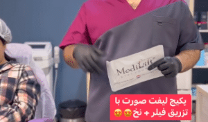 نمونه لیفت صورت دکتر محسن پور آریا