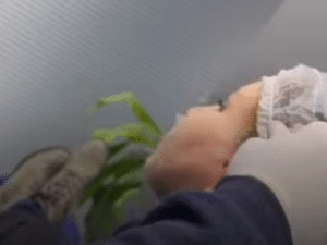 نمونه لیفت صورت کلینیک زیبایی کاژه