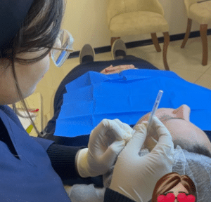 نمونه لیفت صورت با نخ دکتر سحر مروج